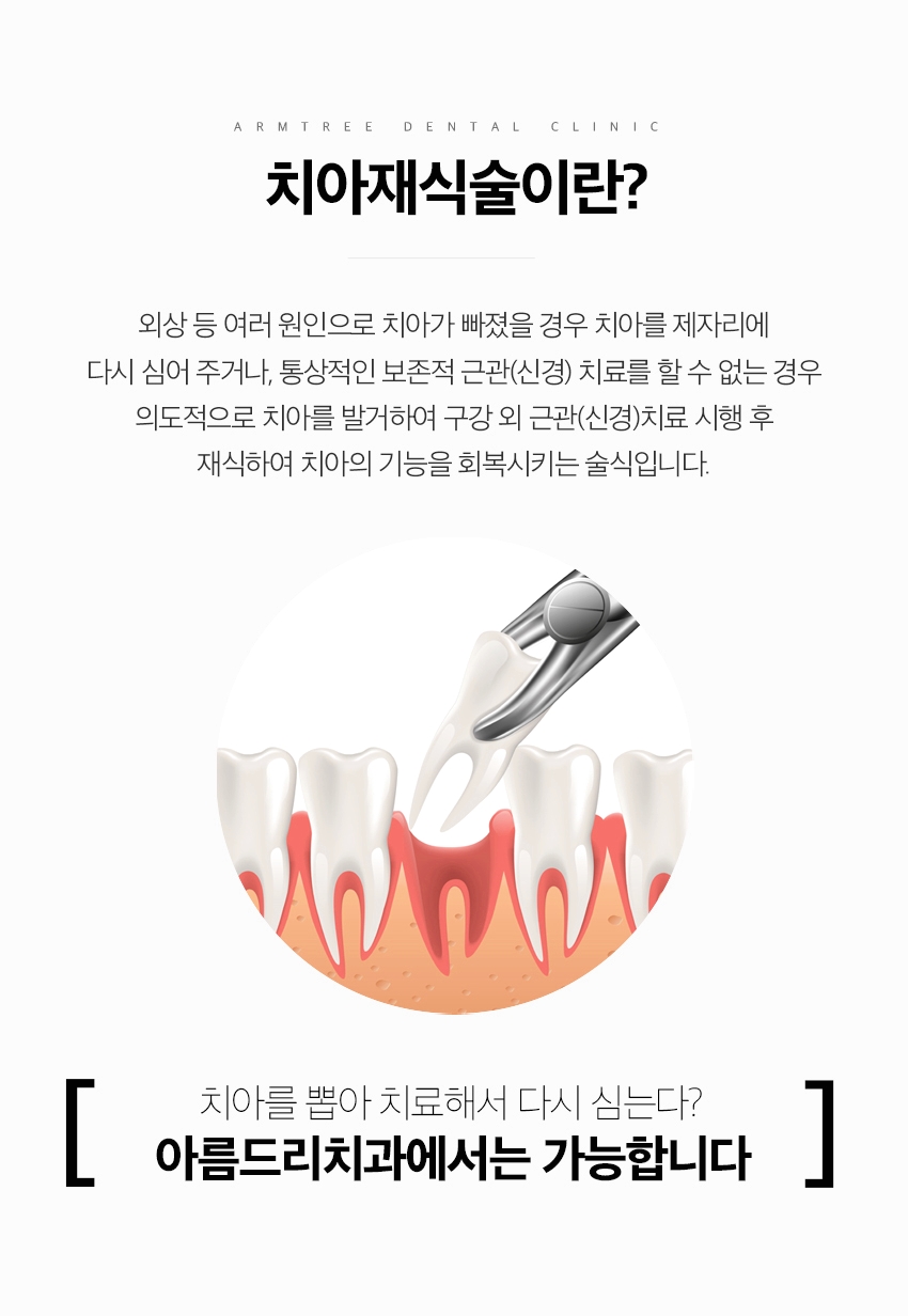 잇몸고름주머니치료 염증제거 아름드리치과 관련 이미지 8