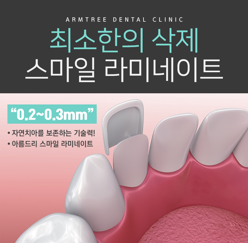 토끼이빨라미네이트 입툭튀 정답은 관련 이미지 5