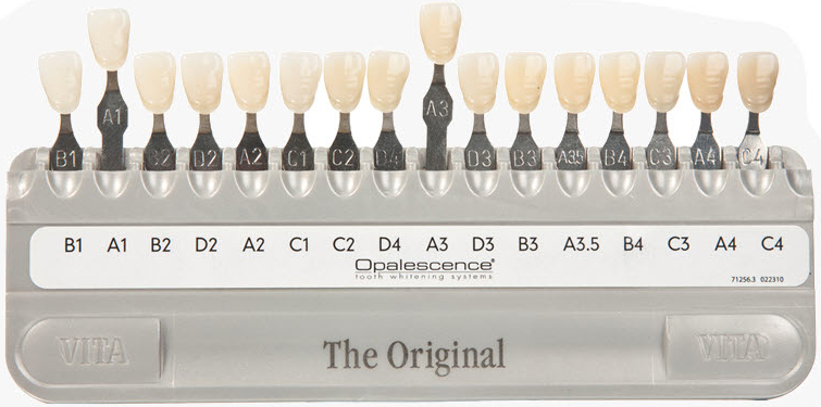 치아미백 효과부터 그 후 모든 것_치과 미백_자가미백 관련 이미지 3