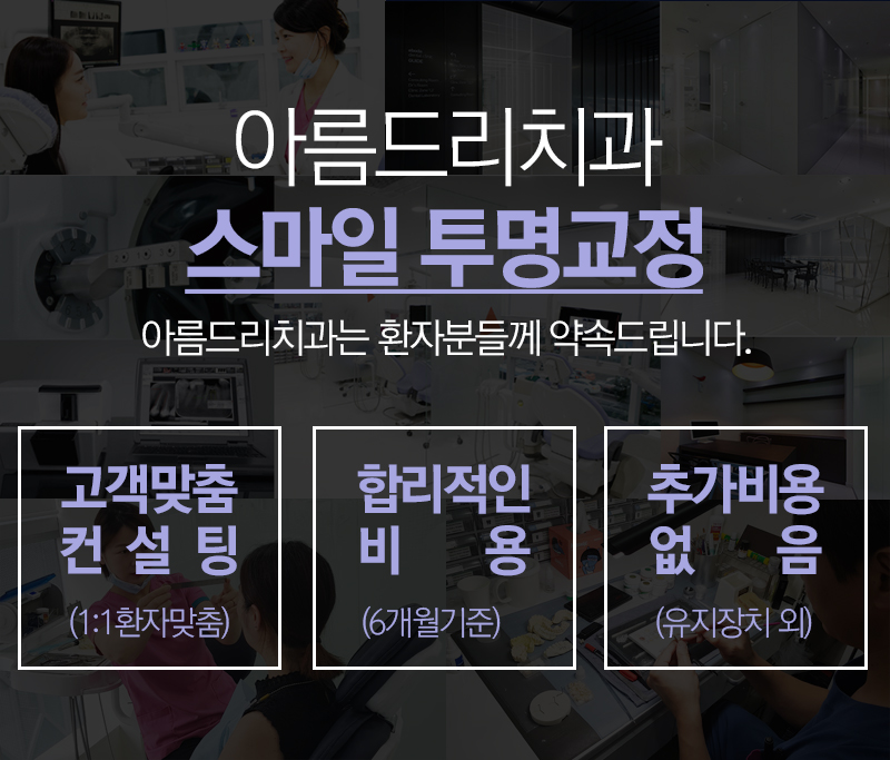 돌출입투명교정 깐깐하게 따지자 관련 이미지 4