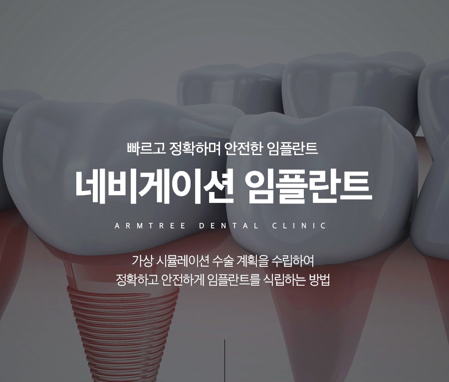 컴퓨터분석임플란트 아름드리치과의 네비게이션이 정답! 관련 이미지 1