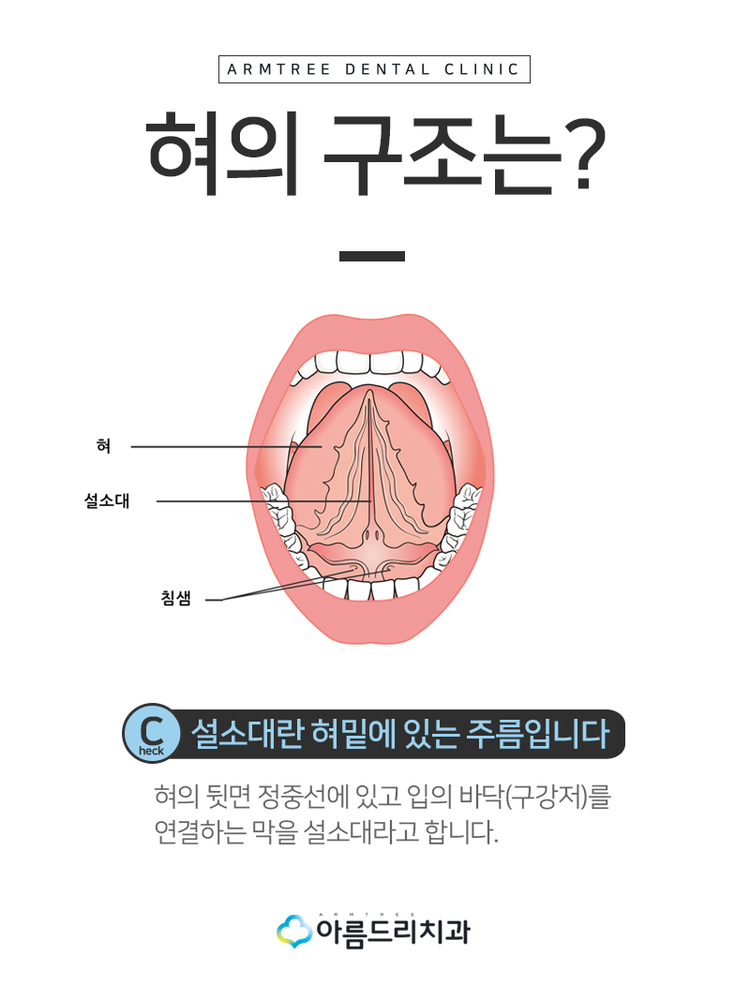 설소대수술 단축증후기 아름드리 관련 이미지 5