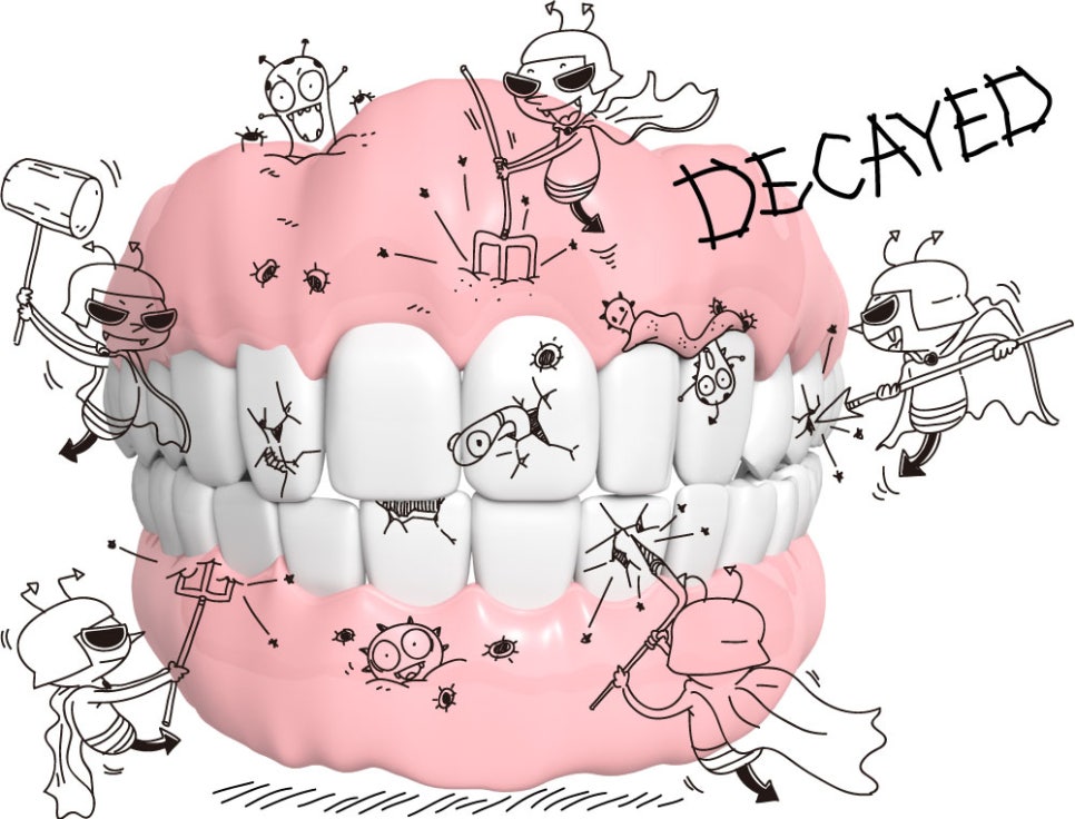 구내염은 왜? 신논현역 치과_아름드리 치과 관련 이미지 2