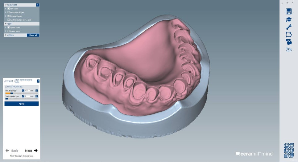 [신논현 치과] 3D 구강 스캐너_정확하게 본뜨기 관련 이미지 9