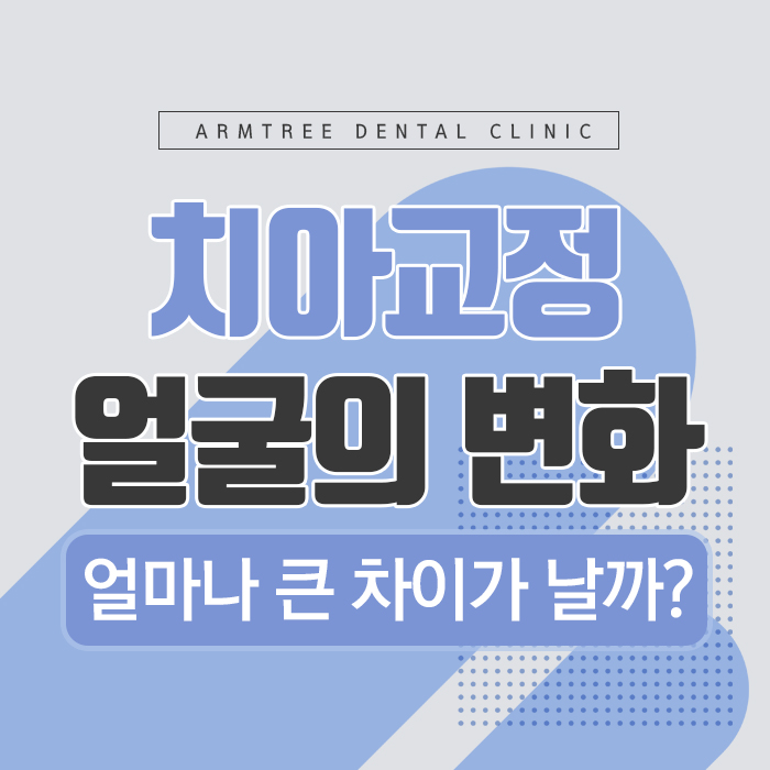 치아교정얼굴변화 어떠한가? 관련 이미지 2