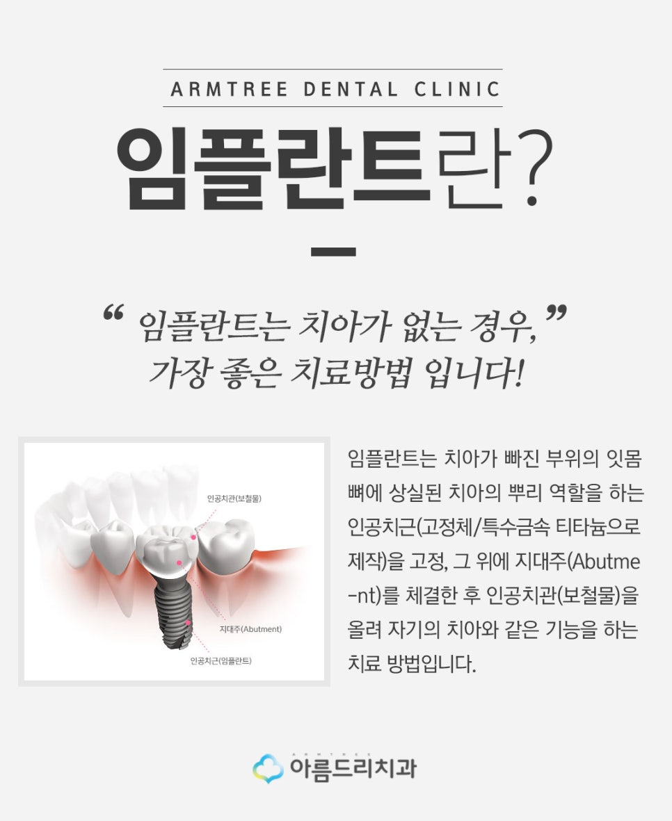 인플란트통증 네비게이션인플란트 걱정없음 관련 이미지 2