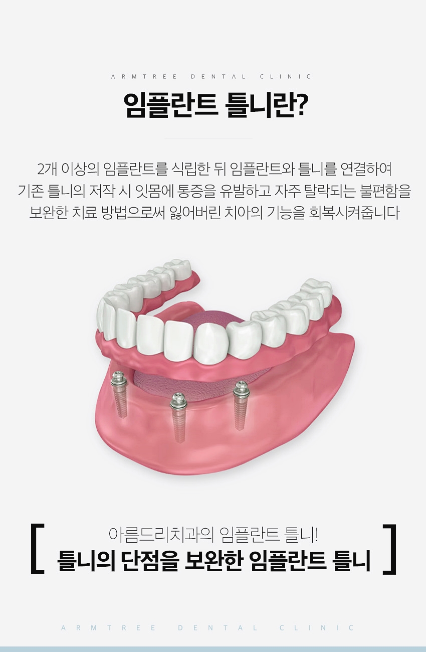 임플란트틀니 아름드리치과에 만족하면서 관련 이미지 3
