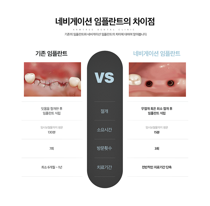 아름드리치과 임플란트의 안전성과 정확성을 높이다 관련 이미지 5