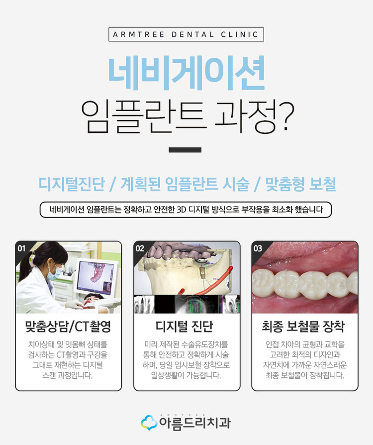 네비게이션임플란트 부작용과 통증놉 관련 이미지 5