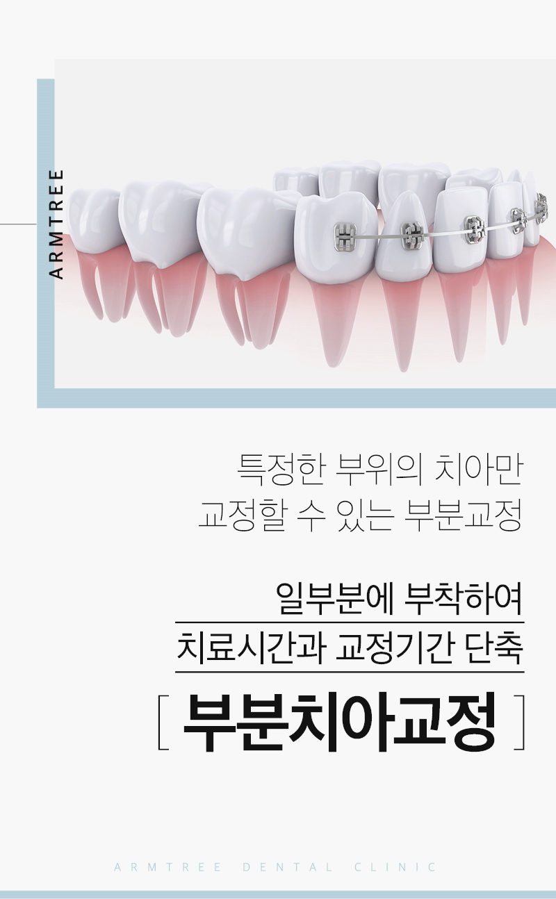 부분교정기간 단기간에 신논현 아름드리치과 관련 이미지 2