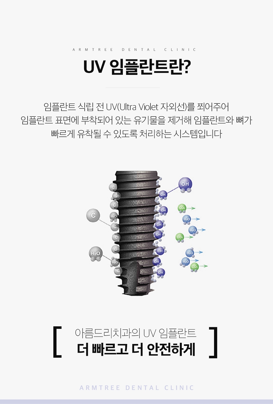 UV임플란트 정확한 아름드리치과 관련 이미지 3