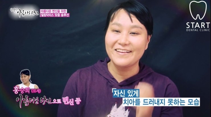 이현정 원장의 아름다운 당신 시즌 1 (9회 홍승희 도전자) 잇몸미백, 치아미백 관련 이미지 1