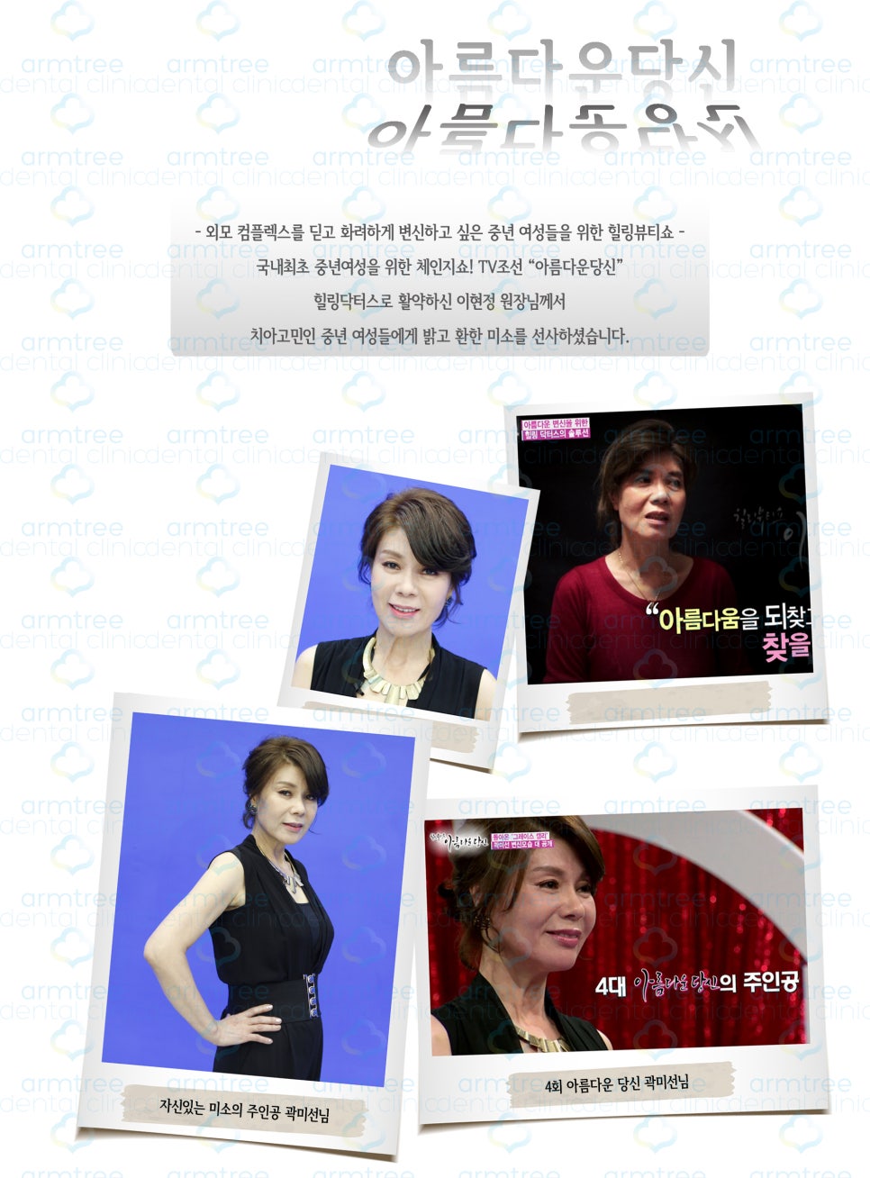 이현정원장의 아름다운 당신 시즌 1(4회 곽미선 도전자)신경치료, 심미보철, 보철치료, 올세라믹 관련 이미지 15