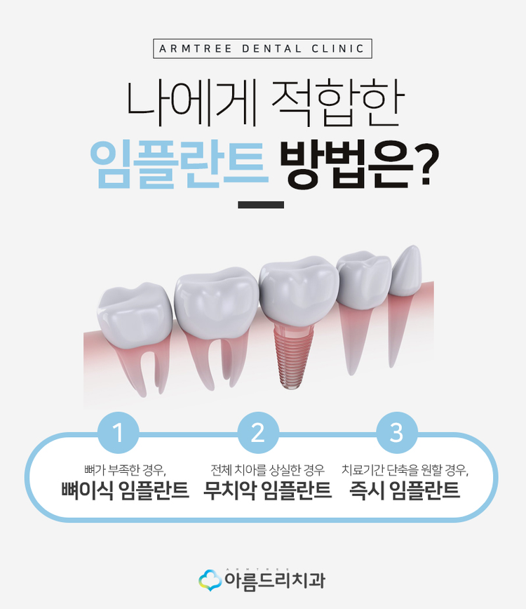 네비게이션임플란트 부작용과 통증놉 관련 이미지 3