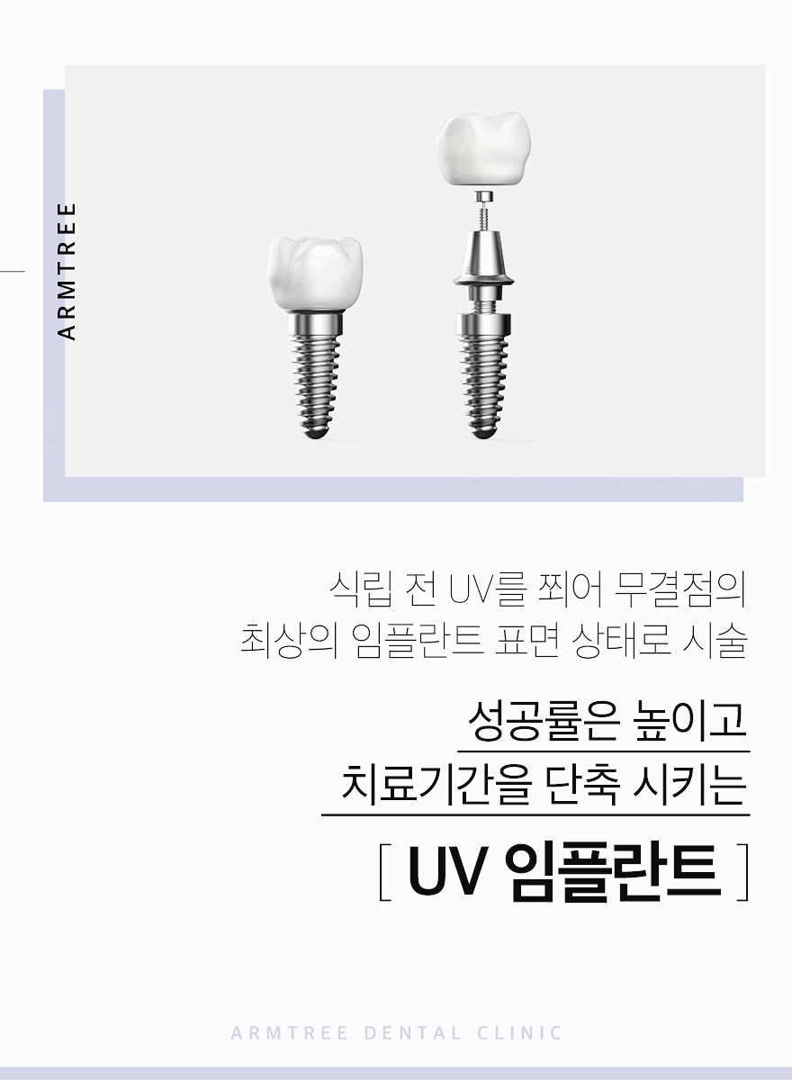 UV임플란트 꼼꼼히 따져보면 관련 이미지 2