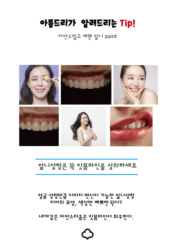 건강한 앞니성형_강남 아름드리 치과가 알려드리는 TIP 관련 이미지 1