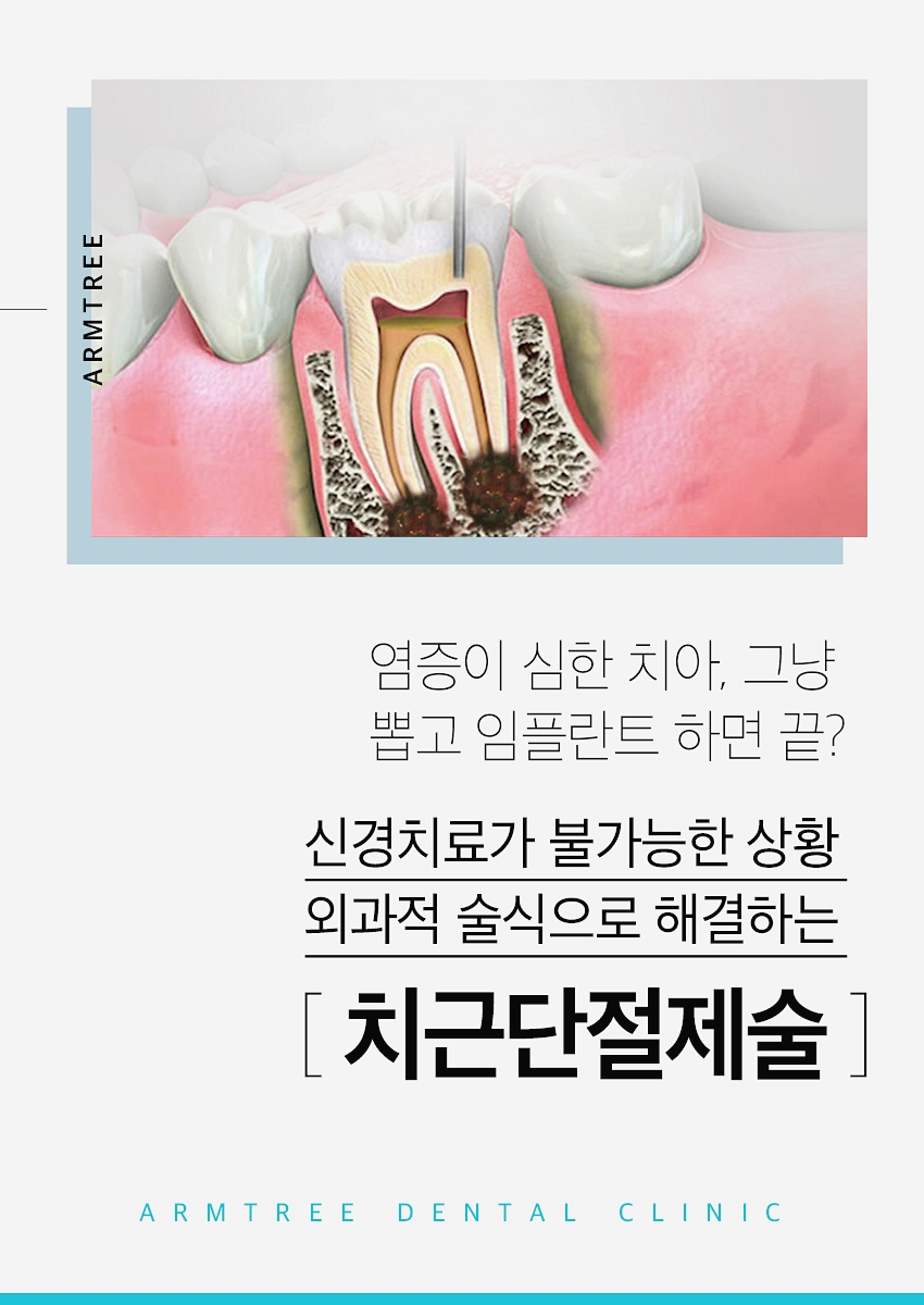 치근단절제술 염증 신뢰있는 후기 아름드리치과 관련 이미지 2