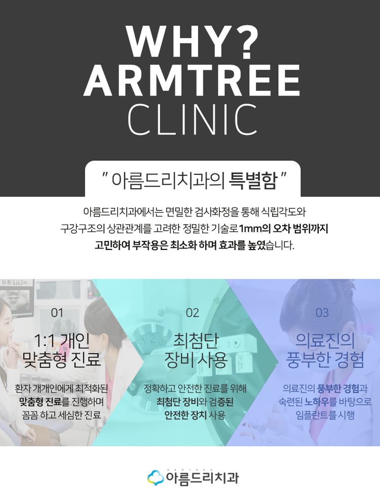 네비게이션임플란트 부작용은 저리가 관련 이미지 6