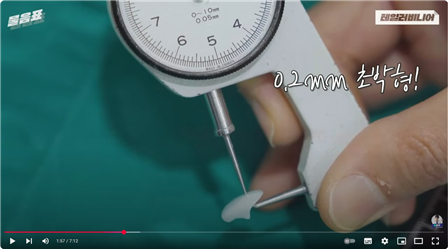 하루 2명만 받을 수 있는 정밀 치료 테일러 비니어란?! 관련 이미지 3