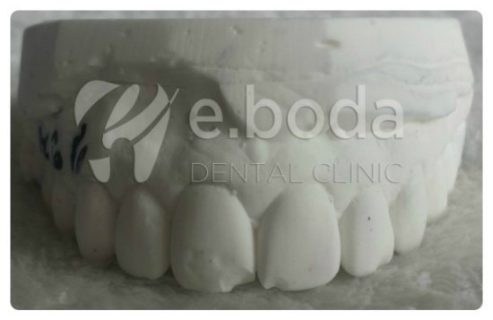 응답하라1988교정기녀 미옥이의 교정 이야기 관련 이미지 5