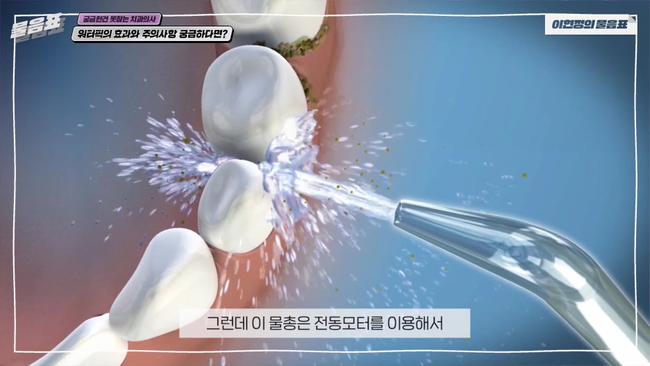 워터픽 효과와 효능 치아와 잇몸건강 #이현정의물음표 관련 이미지 8