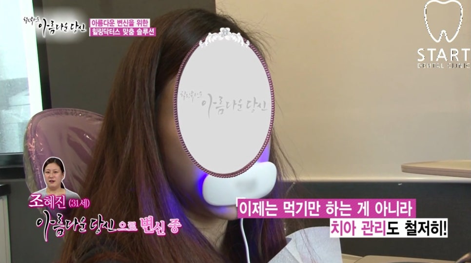 이현정 원장의 아름다운 당신 시즌 1 (9회 조혜진 도전자) 치아성형, 라미네이트, 치아미백, 화이트랩스 관련 이미지 4
