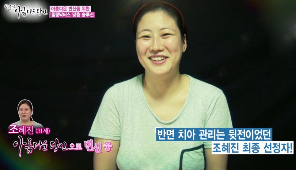 이현정 원장의 아름다운 당신 시즌 1 (9회 조혜진 도전자) 치아성형, 라미네이트, 치아미백, 화이트랩스 관련 이미지 1