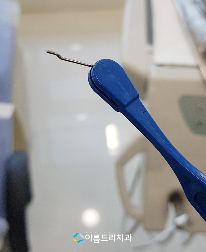 어린이 부정교합교정 RPE 악궁확장장치 관련 이미지 8