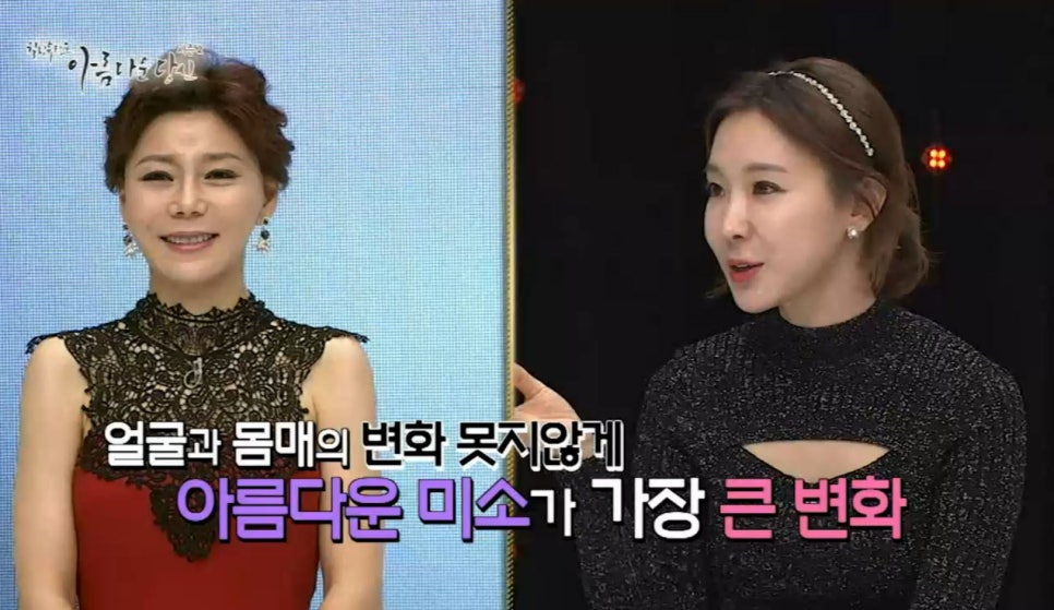 이현정원장의 아름다운 당신 시즌 2(1회 하민주 도전자) 치아 고민 해결 관련 이미지 12