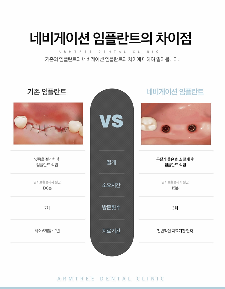 네비게이션임플란트가격 컴퓨터분석 신논현역치과 관련 이미지 4