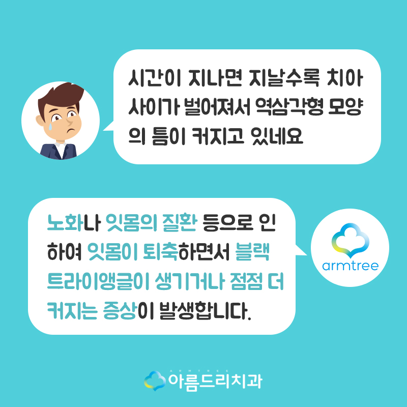 앞니블랙트라이앵글 치료 치아 후기 관련 이미지 2