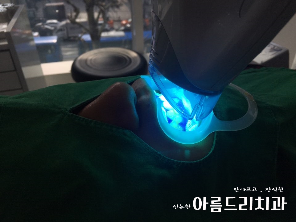 신논현역치과 아름드리치과에서 건강한 치아미백, 전문가 미백 관련 이미지 10