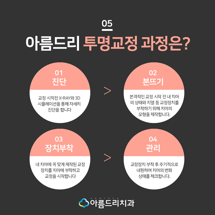 돌출입투명교정 투명교정장치 넘좋다 관련 이미지 6