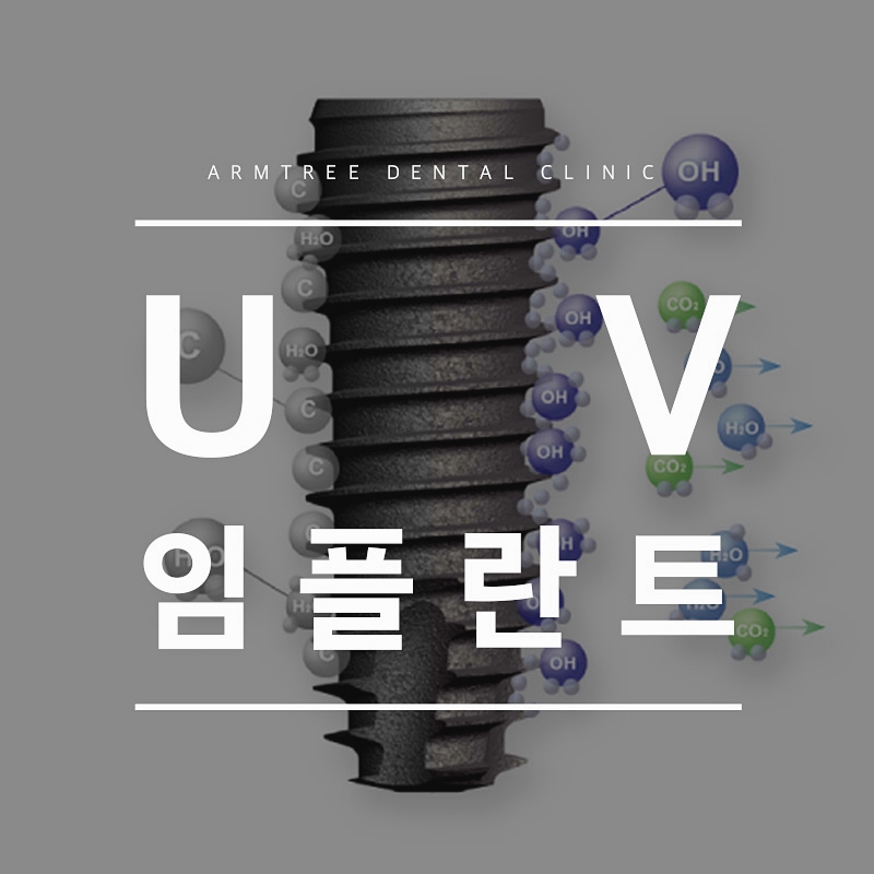 UV임플란트 꼼꼼히 따져보면 관련 이미지 1