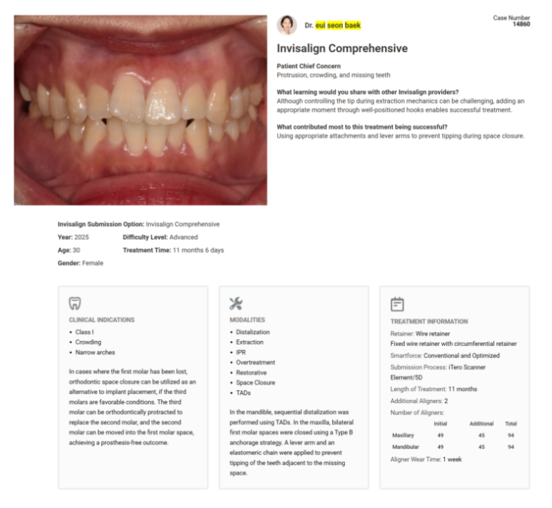 19번째 글로벌 갤러리 등재 소식 인비절라인 발치교정 부작용 ? 관련 이미지 2