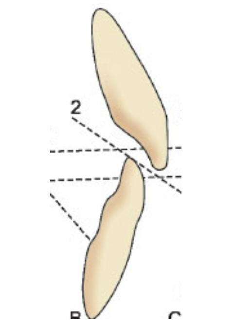 50대 라미네이트 삭제 없이 하는 법? 관련 이미지 5