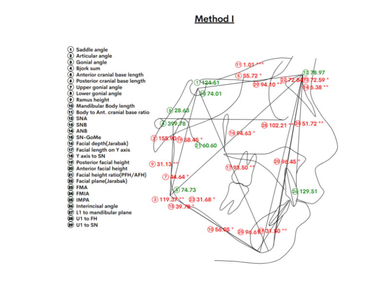 어린이 무턱 성장교정 덧니 인비절라인 퍼스트 악궁확장 치료기간 2년 관련 이미지 6
