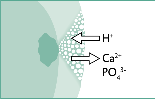 치아 흰색 얼룩 ? 갈아내지 않고 치료하는 법 관련 이미지 2
