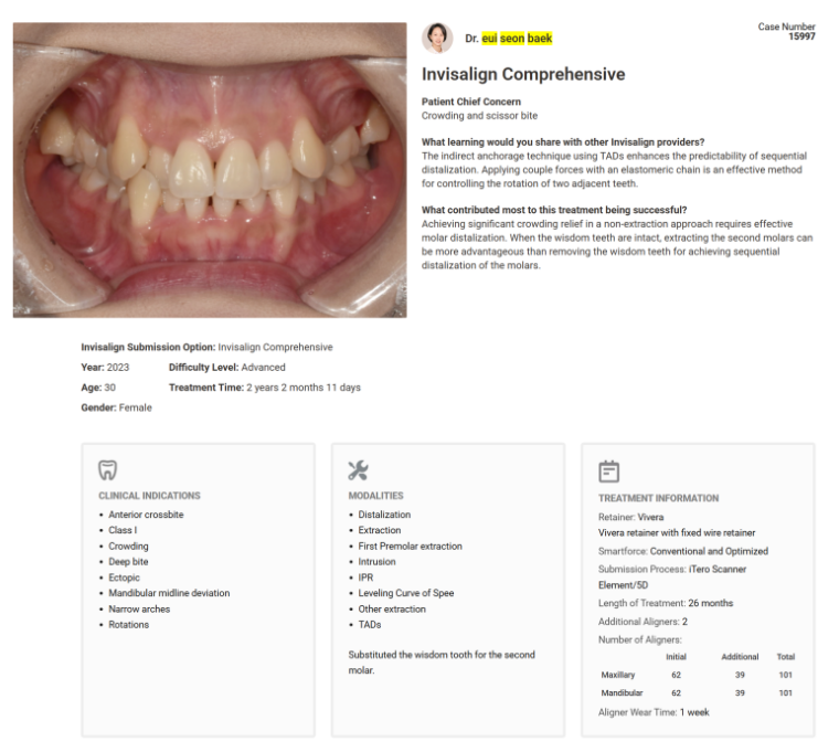 19번째 글로벌 갤러리 등재 소식 인비절라인 발치교정 부작용 ? 관련 이미지 1