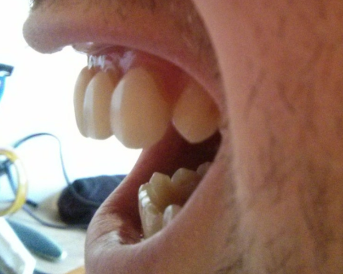 무삭제 라미네이트 아무곳에서 하지 마세요. 관련 이미지 4