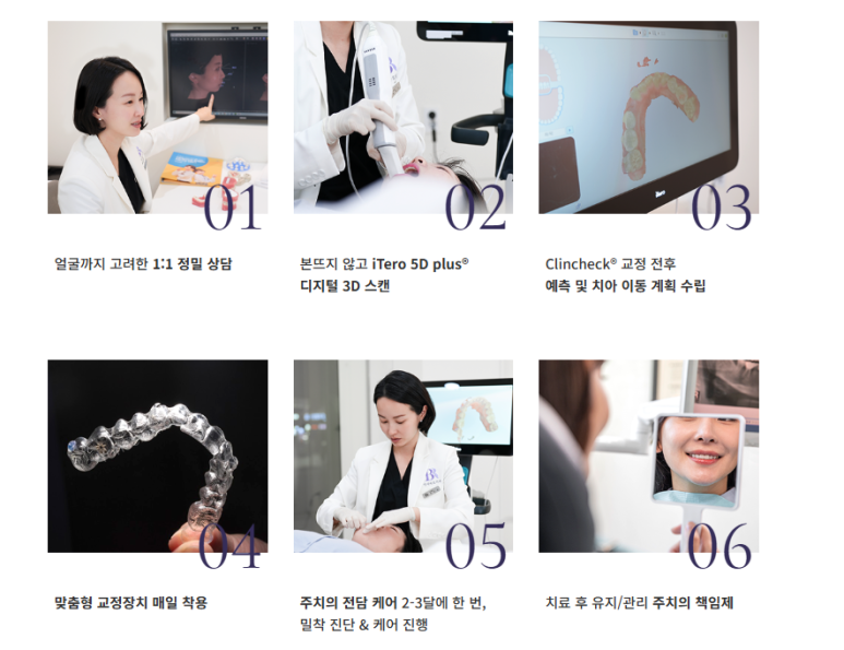 투명한 치아교정장치 인비절라인 종류 알아보기 관련 이미지 2