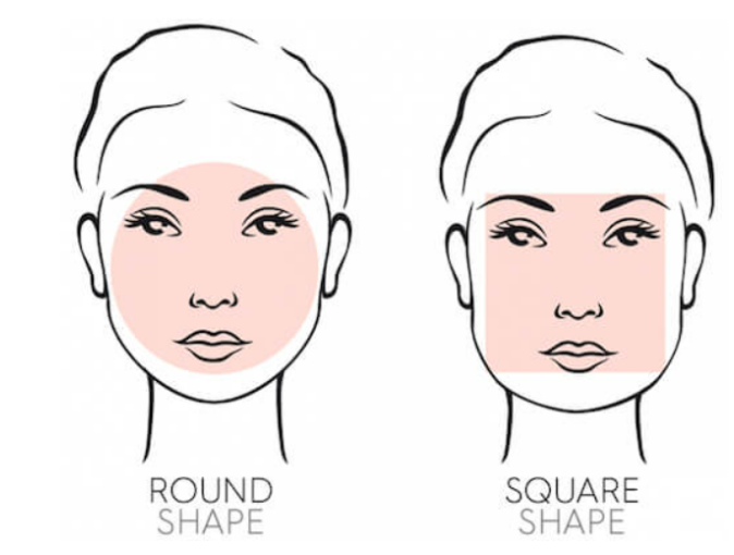 No-Prep Veneers Are Not the Right Treatment for Everyone image 1