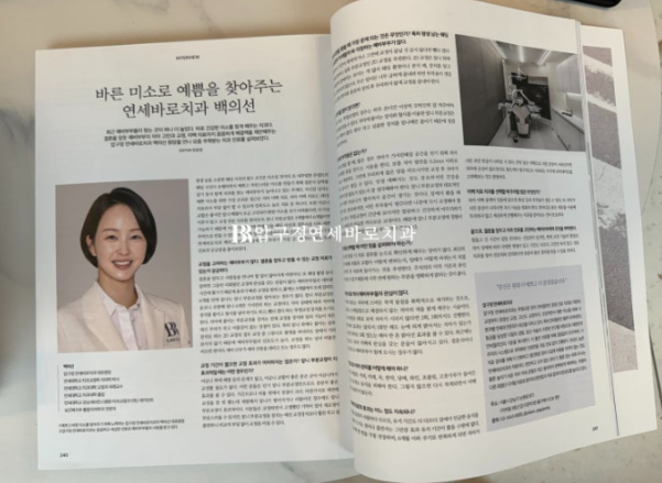 예비신부 교정 단기 앞니 부분교정 치료기간 6개월 관련 이미지 2