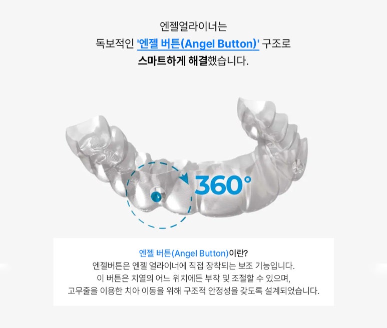 Apgujeong Clear Aligner Recommendation: What Are the Benefits of Angel Aligner? If You’re Looking for Discreet Orthodontic Treatment image 4