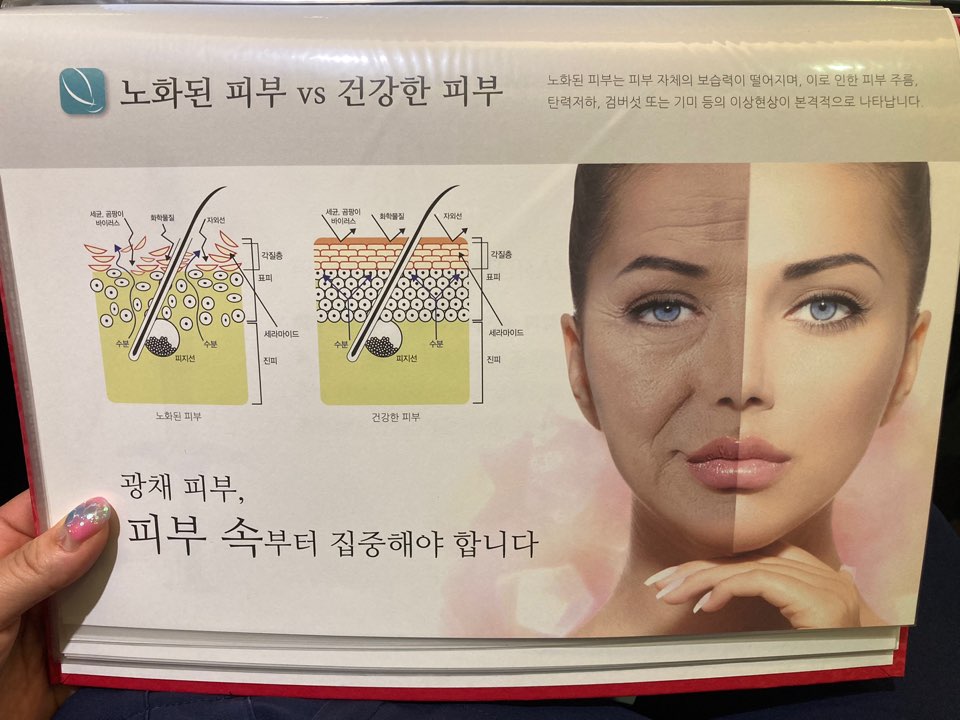 리쥬란 힐러 (피부재생)이벤트! 관련 이미지 2