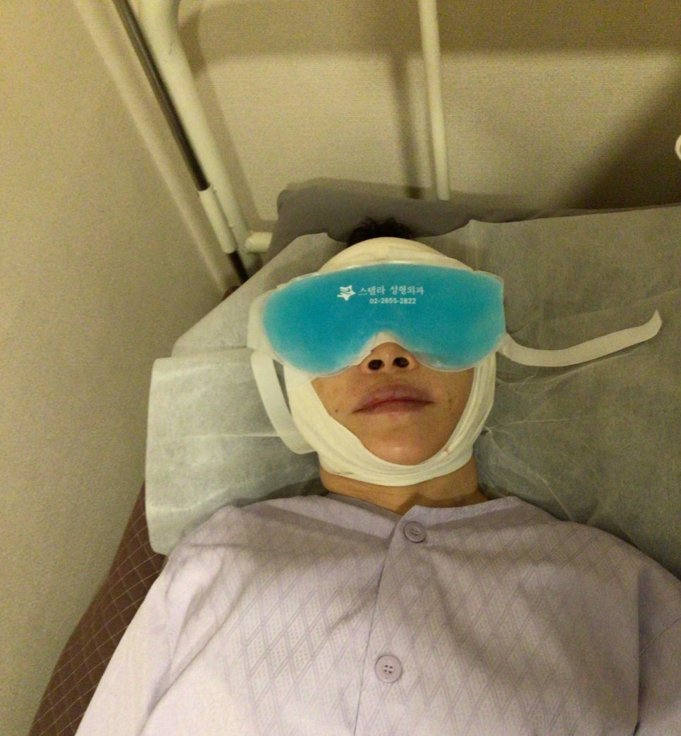 눈상담 받으러 왔다가 풀안면거상까지 하게된 60대중반 중년 어머님 (전/후) /목동 성형외과 스텔라성형 관련 이미지 10