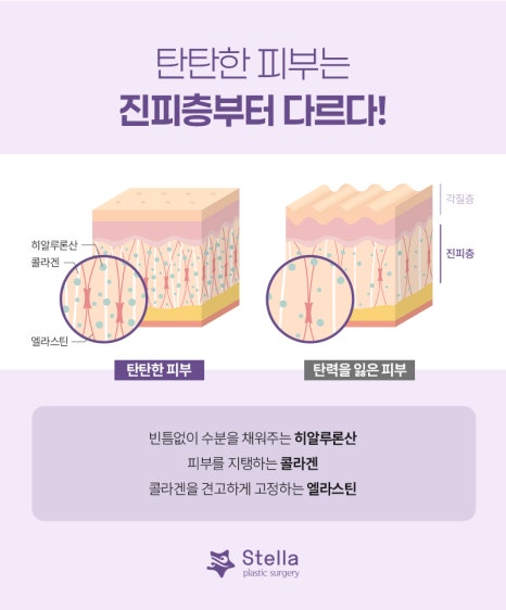 Mok-dong/Omok-gyo Stella Rejuran/Juvelook/Water Glow/Skin Botox: Why Does It Need to Be Properly Delivered into the Dermis During the Procedure? image 4