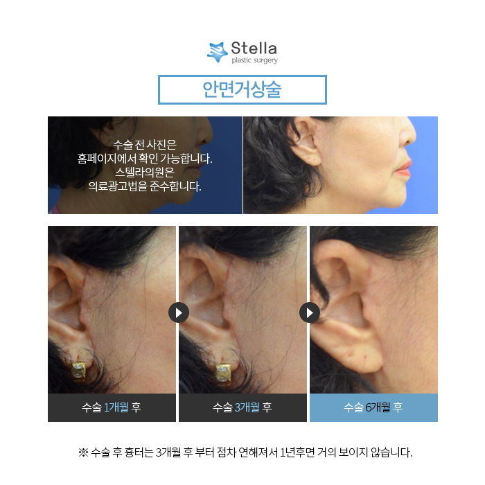 10년전으로 돌아갈 수 있다면, 돌아가시겠어요? 관련 이미지 11