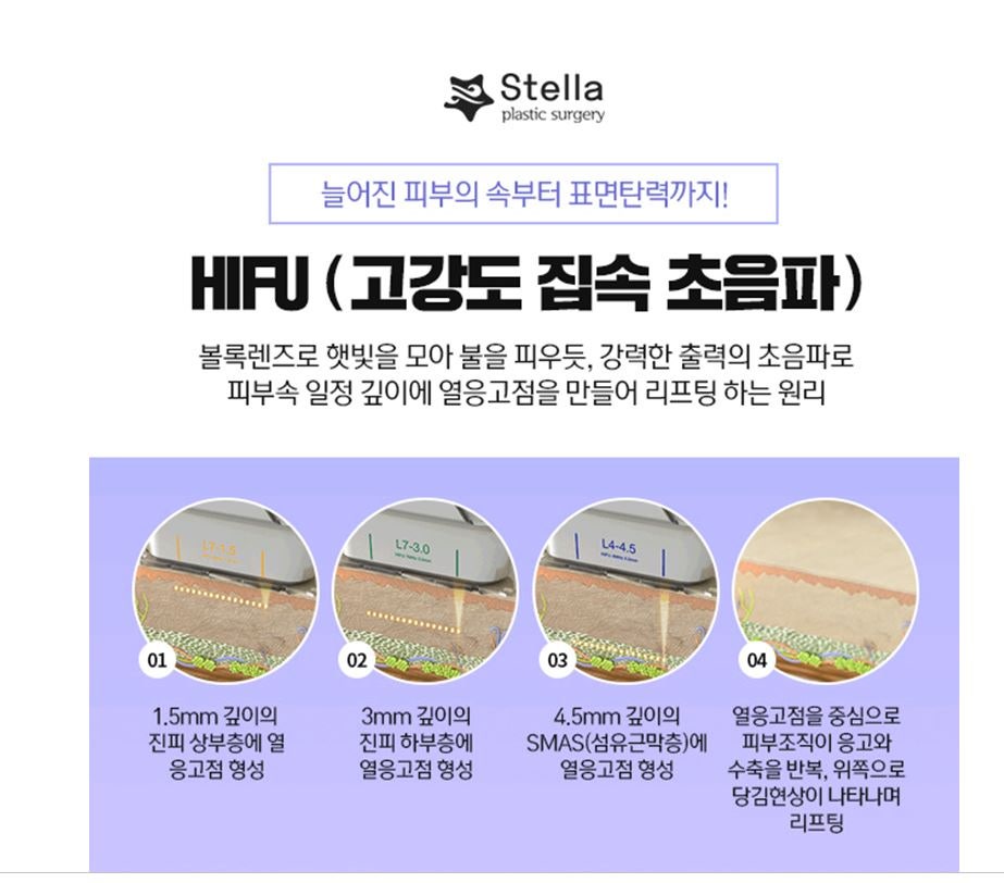 목동 리프팅 탄력 슈링크레이저! 관련 이미지 2