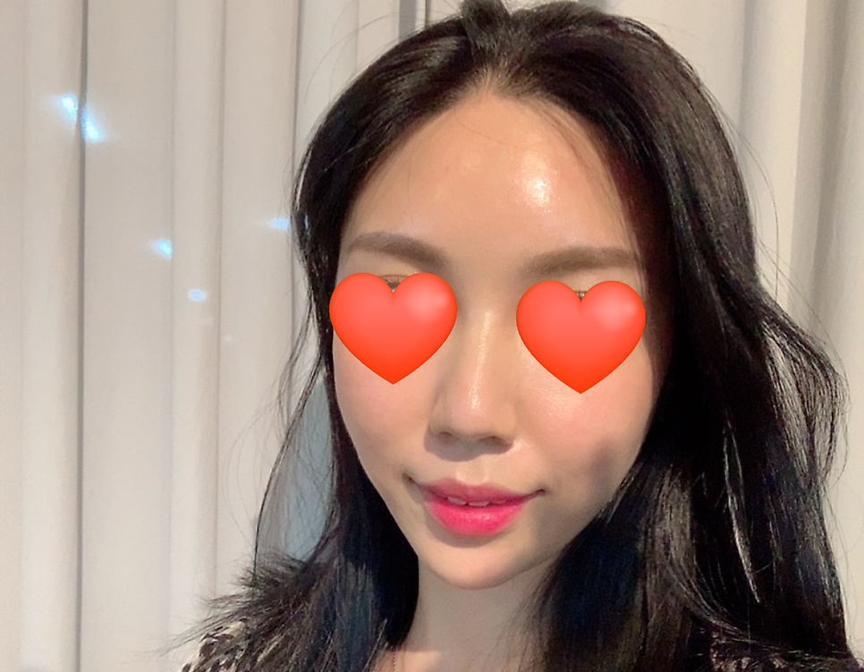 목동 스텔라 직원이 직접 받아본 콜라겐쥬베룩~&hearts; 관련 이미지 10